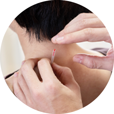 鍼灸